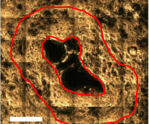 Tumore del pancreas: a Pisa sviluppata una nuova tecnica diagnostica che combina spettroscopia Raman e intelligenza artificiale