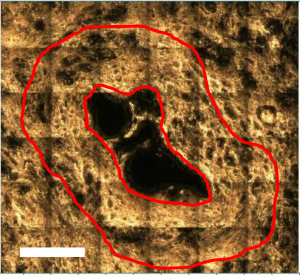 Tumore del pancreas: a Pisa sviluppata una nuova tecnica diagnostica che combina spettroscopia Raman e intelligenza artificiale