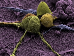 Silicon nanowires for the study of chronic pain